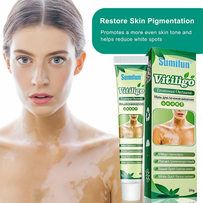 Picture of Sumifun Vitiligo Treatment Ointment 20g