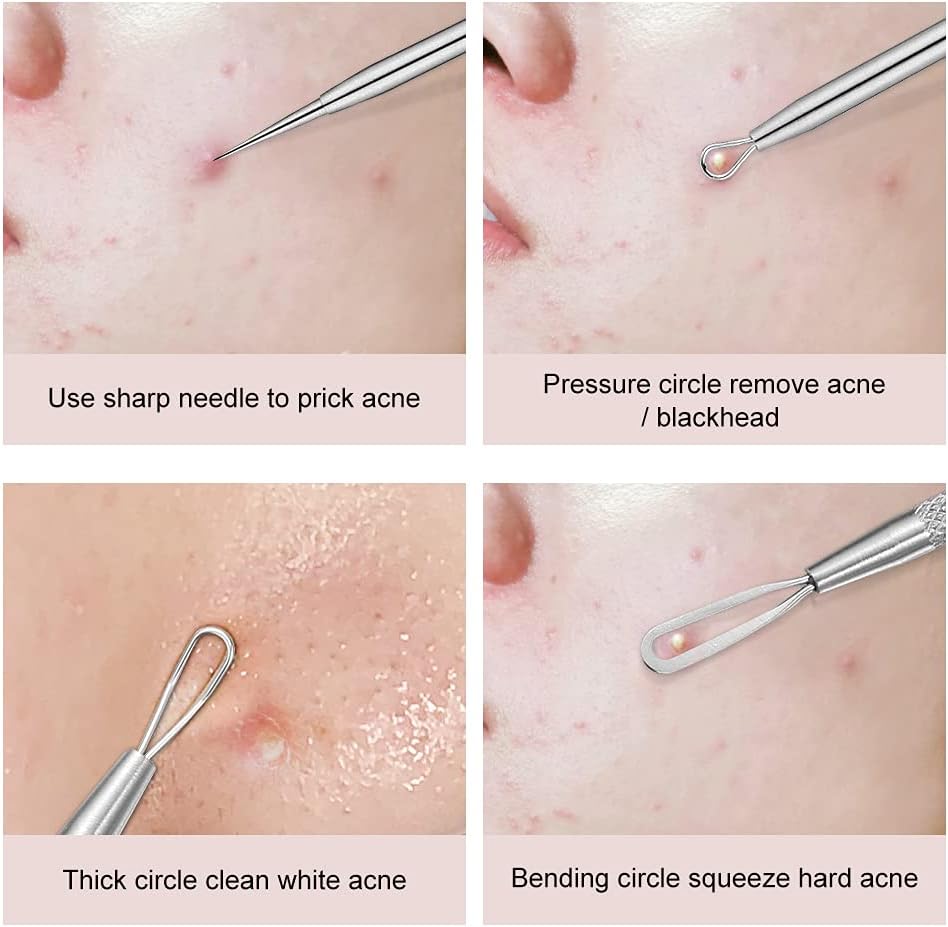 Picture of Blackhead Remover, 2 PCS Pimple Popper ，Stainless Steel Pimple Extractor Blackhead Removal Tool Risk Free Treatment for Blemish,Whitehead Popping