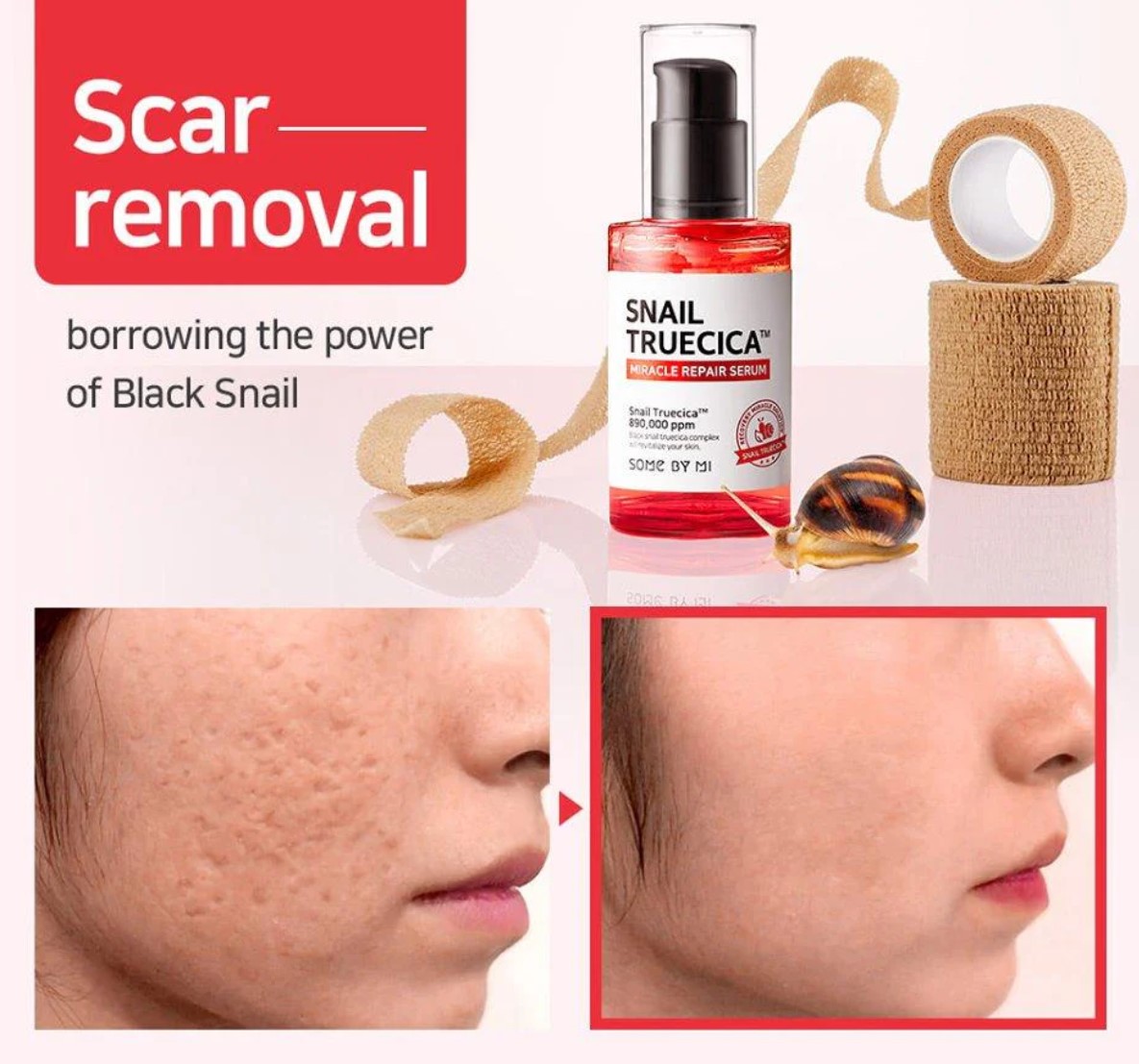 Picture of Some By Mi Snail Truecica Miracle Repair Serum 50ml