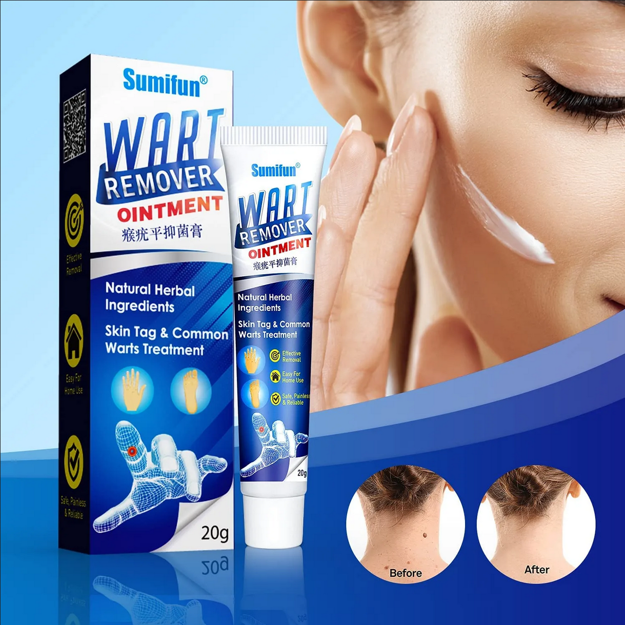 Picture of Sumifun Wart Remover Ointment 20g
