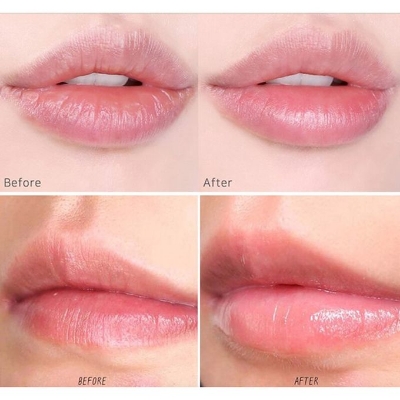 Picture of Lip Sleeping Mask Mini Kit 1 Pcs 8g