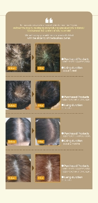 Picture of Helps improve hair loss and hair health. Beer yeast shampoo 300ml [Home Rose KOREA]