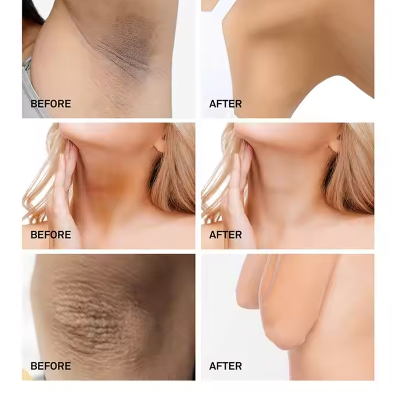 Picture of 3W Clinic Underarm Whitening Multi Cream 100g