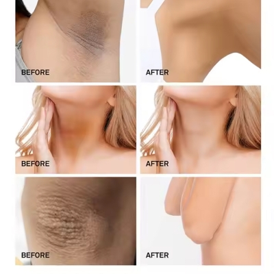 Picture of 3W Clinic Underarm Whitening Multi Cream 100g