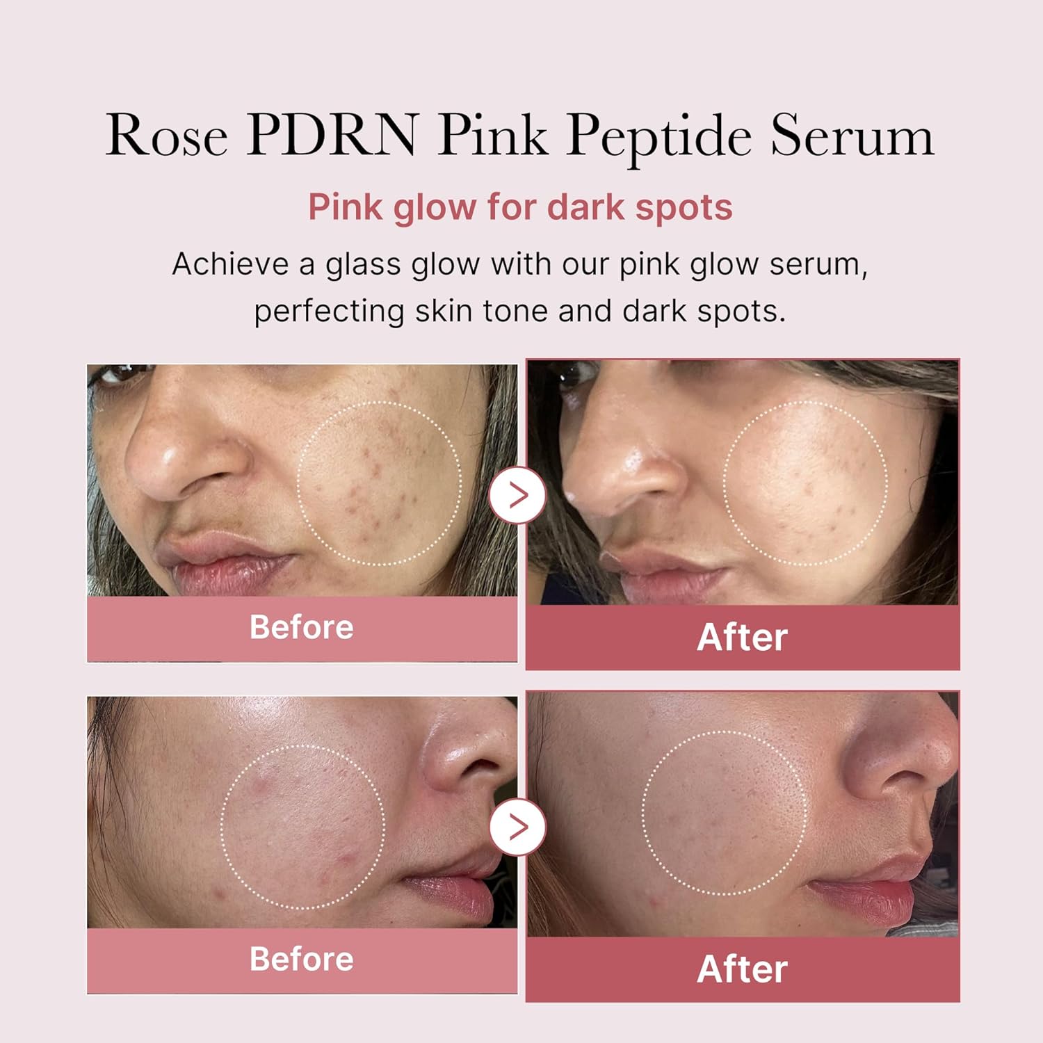 Picture of medicube PDRN Pink Peptide Serum 30ml