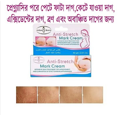 Picture of Aichun Beauty Anti-Stretch Marks Cream | Stretch Marks Removal Cream 60g