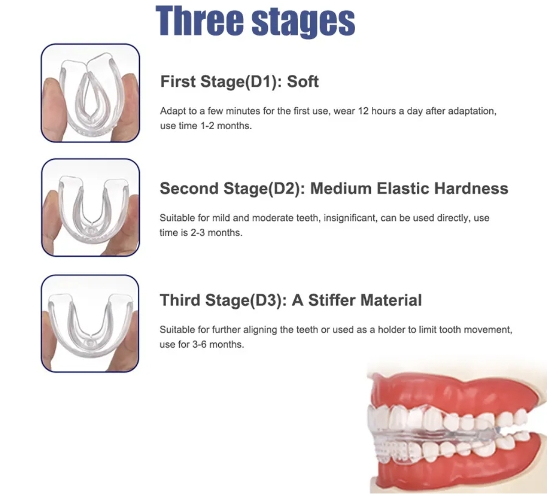 Picture of Orthodontic Retainers Braces 3-Stage Teeth Straightening Trainer for Different Tooth Alignments Multi-Purpose Oral Hygiene