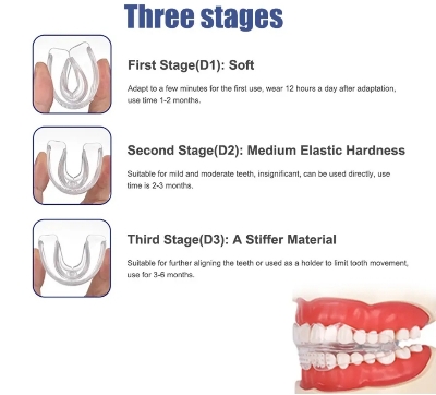 Picture of Orthodontic Retainers Braces 3-Stage Teeth Straightening Trainer for Different Tooth Alignments Multi-Purpose Oral Hygiene
