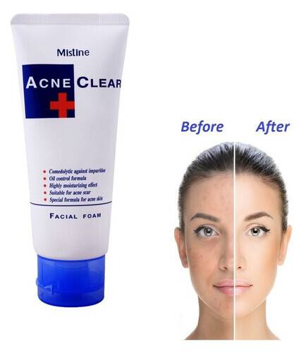 Picture of Mistine ACNE CLEAR FACIAL FOAM Face Wash (85 G)