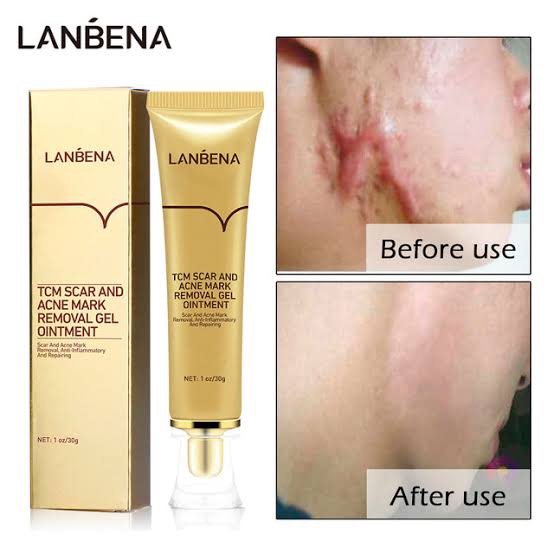 Picture of Lanbena - TCM Scar and Acne Mark Removal Gel Ointment - 30gm