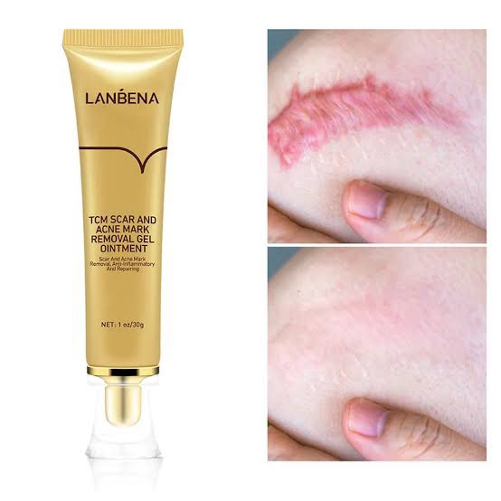 Picture of Lanbena - TCM Scar and Acne Mark Removal Gel Ointment - 30gm