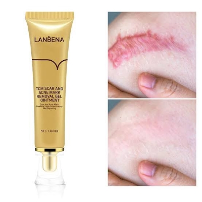 Picture of Lanbena - TCM Scar and Acne Mark Removal Gel Ointment - 30gm