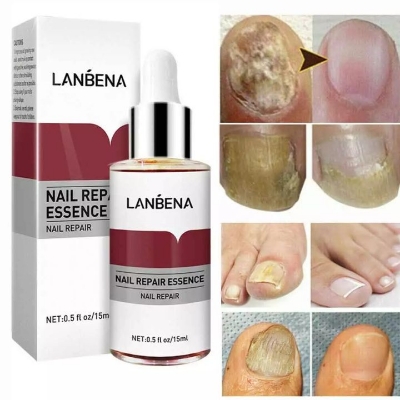 Picture of Lanbena Nail Repair Essence -15ml
