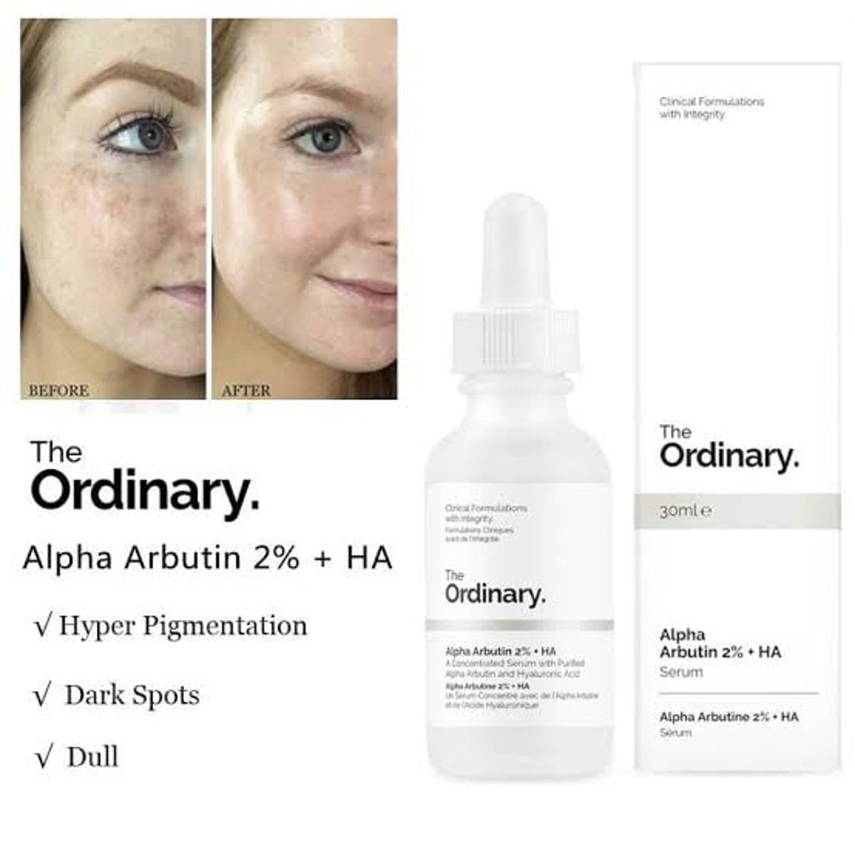 Picture of The Ordinary Alpha Arbutin 2% + HA Serum Full Size 30ml/1oz