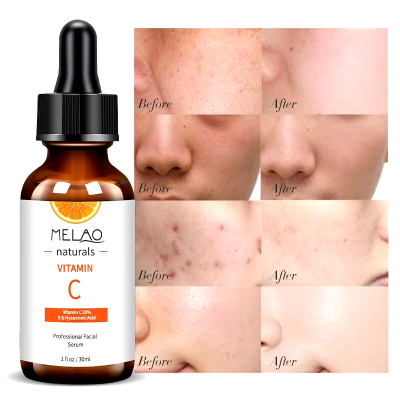 Picture of MELAO Vitamin C Hyaluronic Acid Shrink Pore Face Serum Moisturizing Essence Anti-Aging Anti-Oxidant Dry Skin Care-30ml