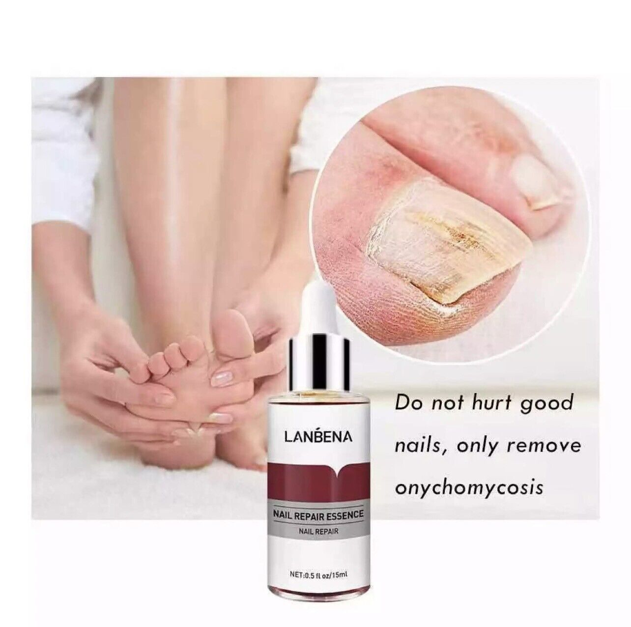 Picture of Lanbena Nail Fungal Treatment Remove Paronychia Onychomycosis Toe Nail Repairing,Treatment Toe Nail Repair Essence Nail Solution-15Ml