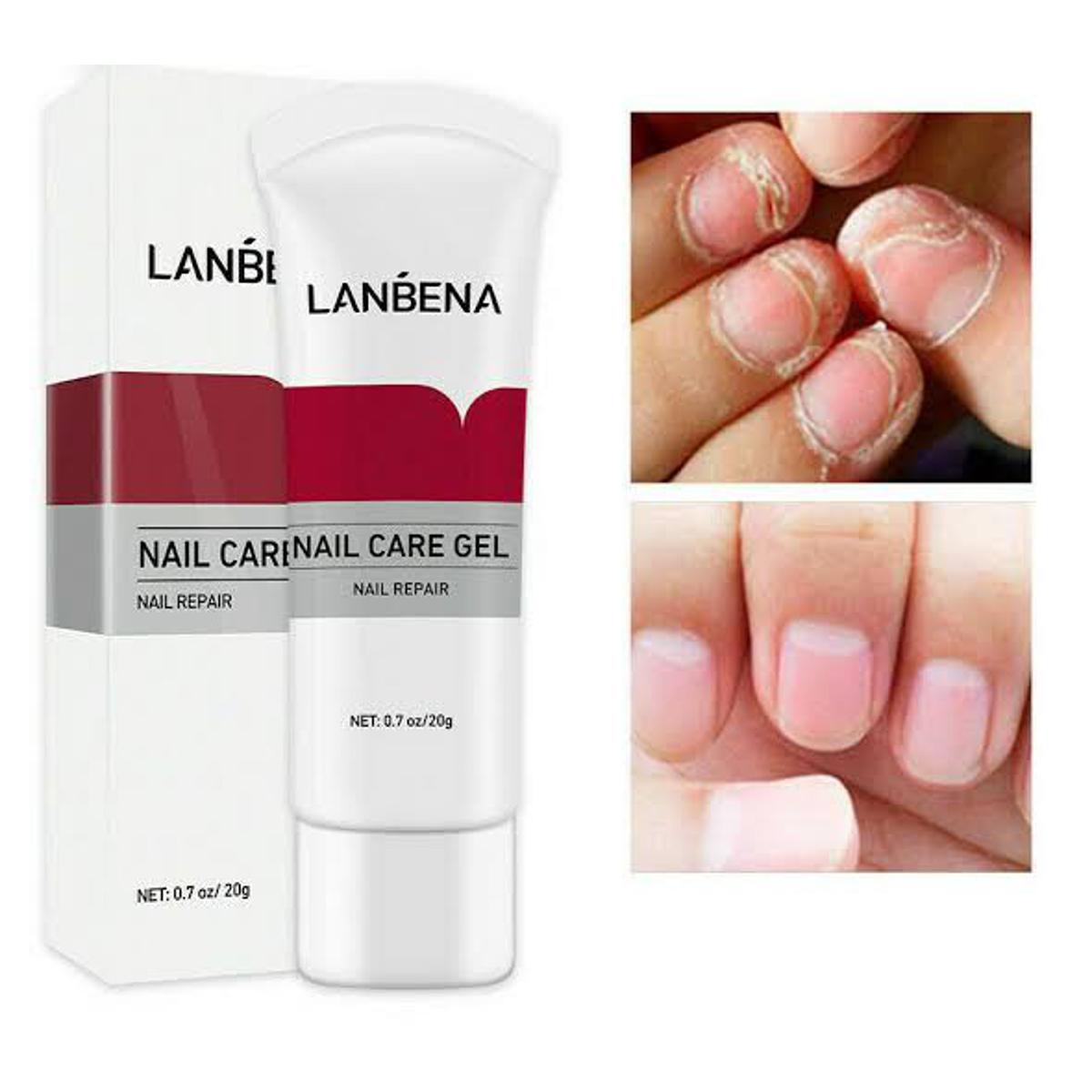 Picture of LANBENA Nail Fungus Removal cream Treatment Onychomycosis Paronychia Anti Infection Feet Toe Nail Care Gel Fungal Nail Product-20GM