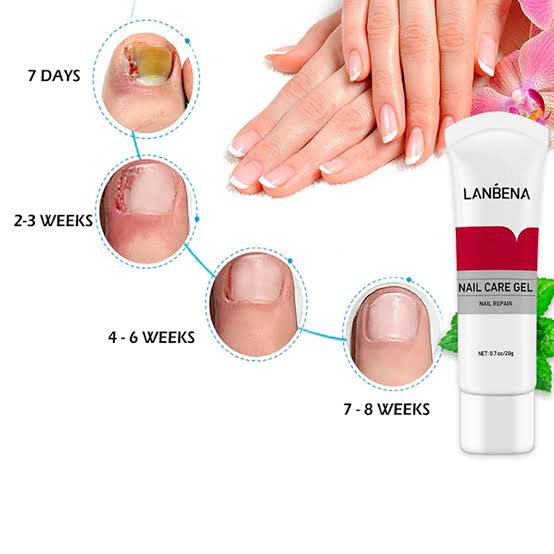 Picture of LANBENA Nail Fungus Removal cream Treatment Onychomycosis Paronychia Anti Infection Feet Toe Nail Care Gel Fungal Nail Product-20GM