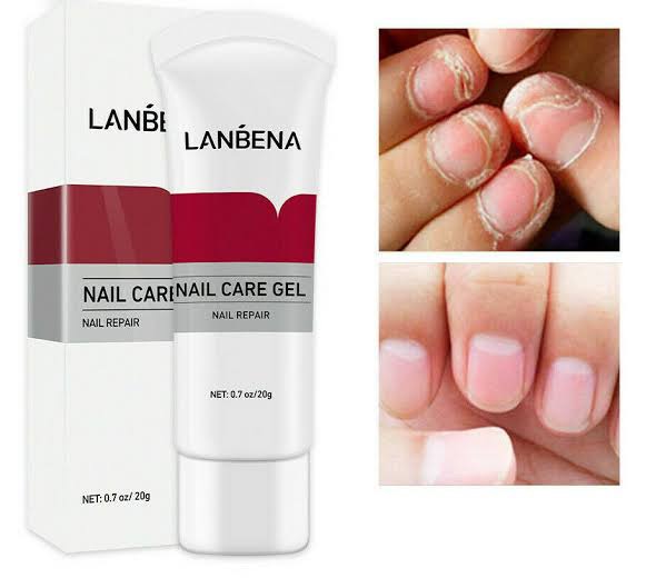 Picture of LANBENA Nail Care Gel Fungal Nail Treatment Remove Onychomycosis Nail Care Nourishing Effective against nail Hand And Foot Care