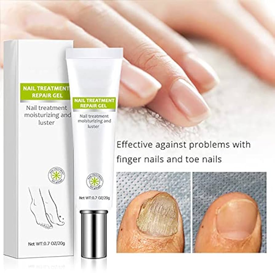 Picture of Efero Nail Cream Treatment Repair Gel and Luster -20gm