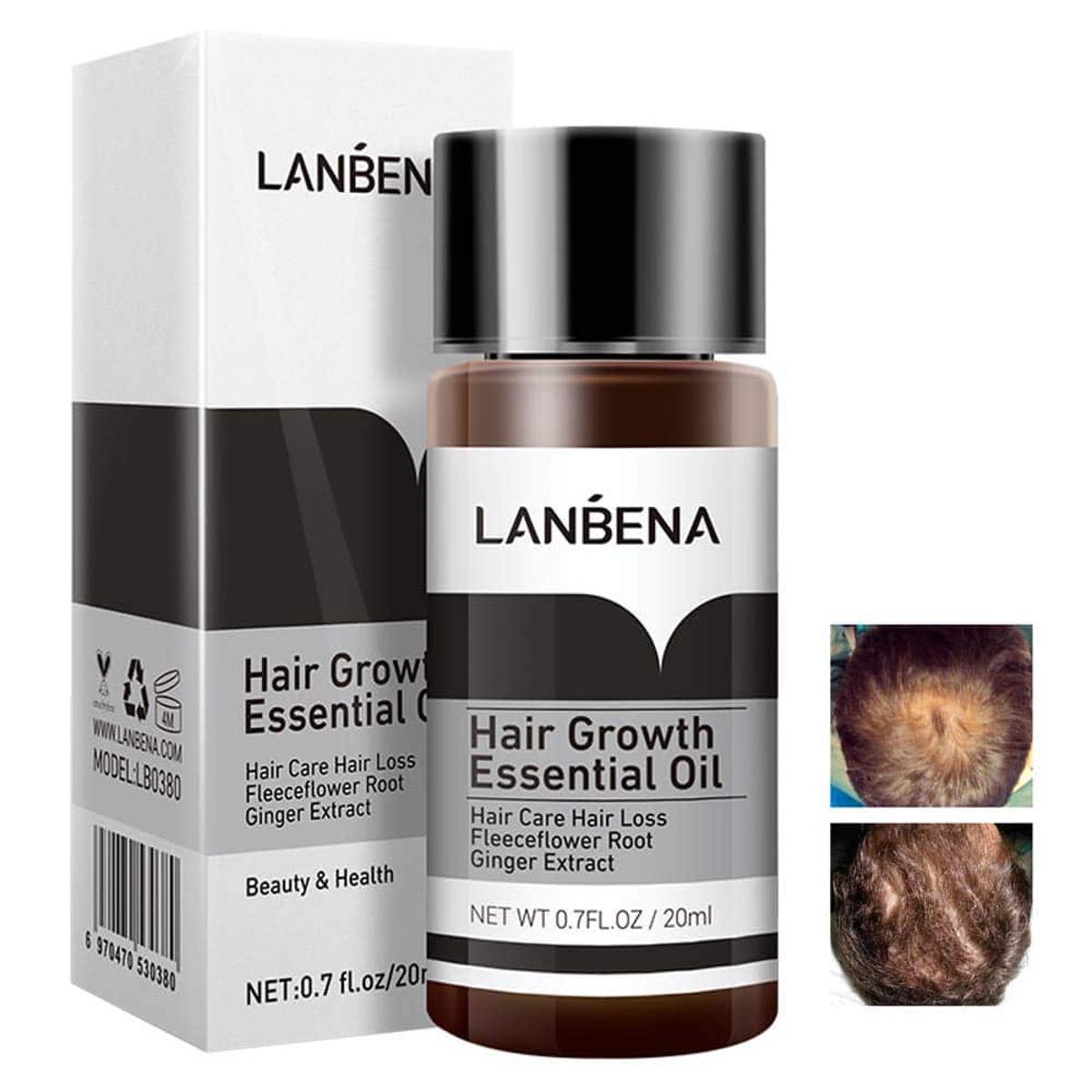 Picture of LANBENA Hair Growth Essencial Oil  Hair Growth Oils for Hair Thickening Hair Loss Treatment Thinning Hair Treatment Growing Hair -20ml