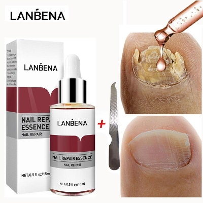 Picture of LANBENA Nail Repair Essence Serum Fungal Nail Treatment Remove Onychomycosis Toe Nourishing Brighten Hand Foot Skin Care 12ml