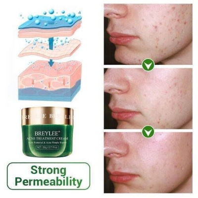 Picture of BRYELEE Acne Treatment Cream Face Cream Pimple Removal Spots Oil Control Anti Acne Shrink Pores Moisturizing Serum Skin Care 20g