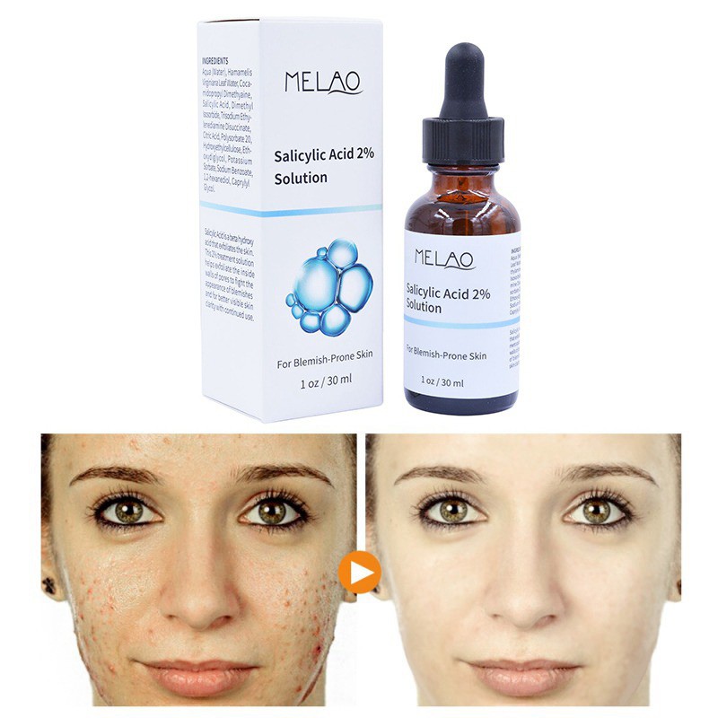 Picture of Melao Salicylic Acid 2% Solution – 30 ml