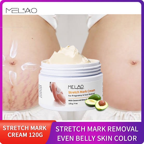 Picture of MELAO Women Remove Pregnancy Scars Acne Cream Stretch Marks Treatment Maternity Repair Anti-Aging  Body Creams-120gm