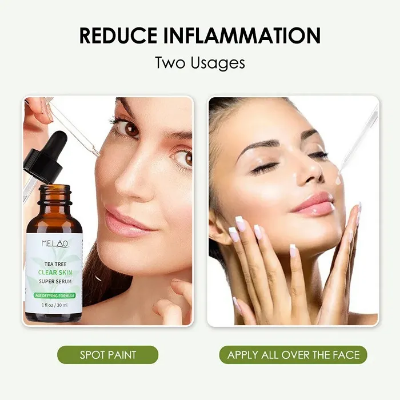 Picture of MELAO TEA TREE CLEAR SKIN SUPER SERUM-30ml