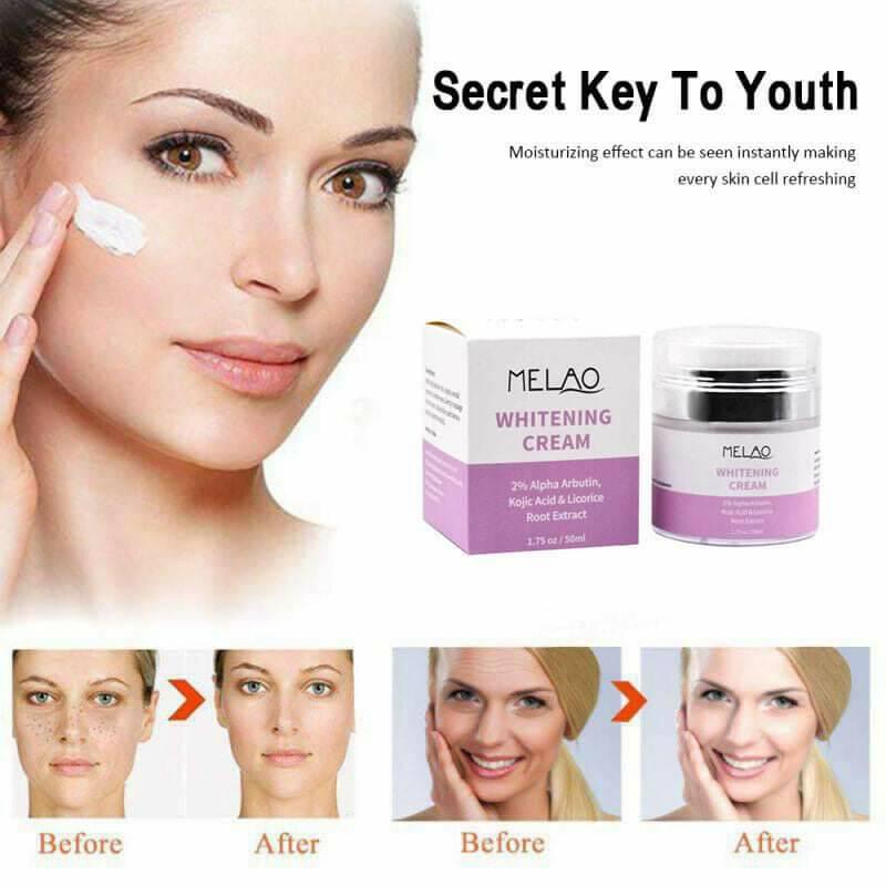 Picture of MELAO Whitening 2% Alpha Arbutin, Kojiac Acid Dark Skin Moisturizing Brighten Face Cream -50gm