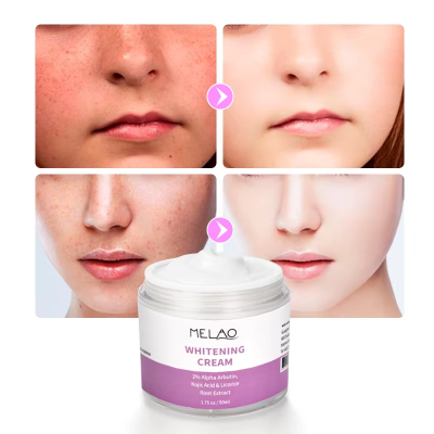 Picture of MELAO Whitening 2% Alpha Arbutin, Kojiac Acid Dark Skin Moisturizing Brighten Face Cream -50gm