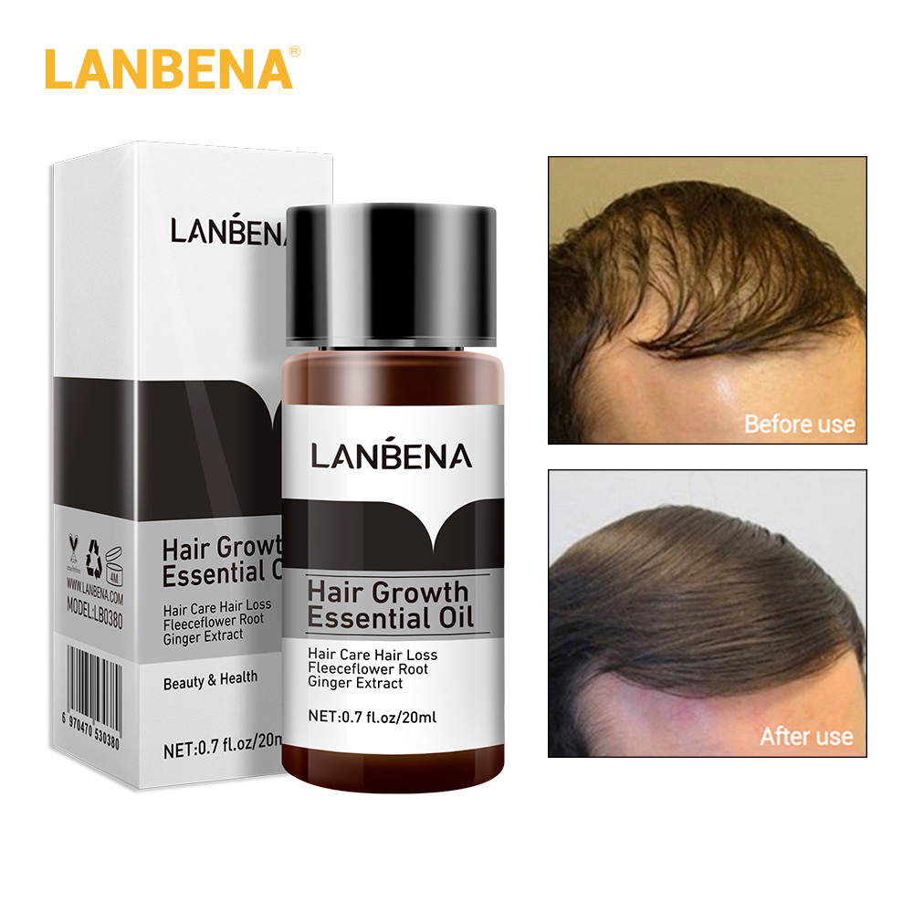 Picture of LANBENA Fast Powerful Hair Growth Essential Oil -20 ml