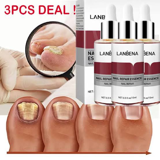 Picture of LANBENA Nail Repair Essence Serum Fungal Nail Treatment [3PCS+Teeth Whitening Essence Free]