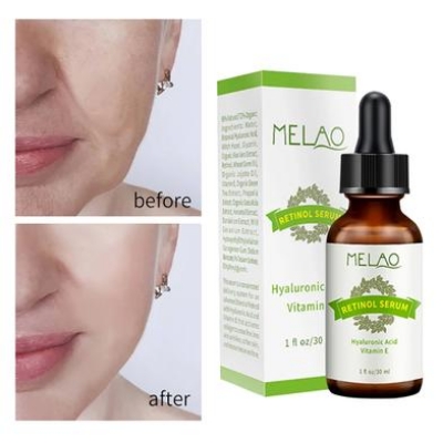 Picture of MELAO Retinol Serum Anti Fine Lines Remove Essence Fade Dark Spots-30ml
