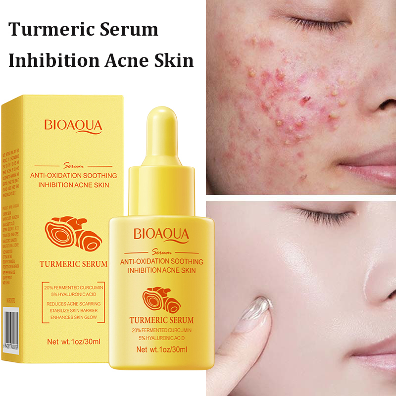 Picture of BIOAQUA Turmeric Facial Serum Anti-Oxidation Soothing Acne Skin Hyaluronic Acid Control Oil Moisturizing Face Skin 30ml