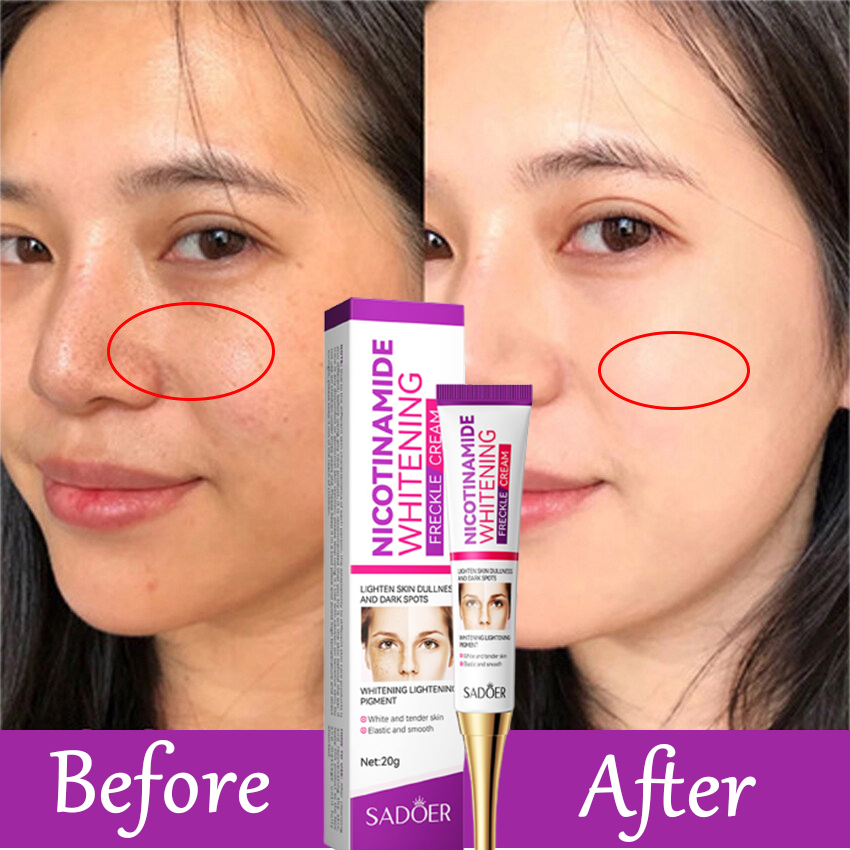 Picture of SADOER Whitening and Freckle Removal Cream Moisturizing Moisturizing and Fading Niacinamide Cream-20gm