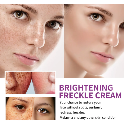 Picture of SADOER Whitening and Freckle Removal Cream Moisturizing Moisturizing and Fading Niacinamide Cream-20gm