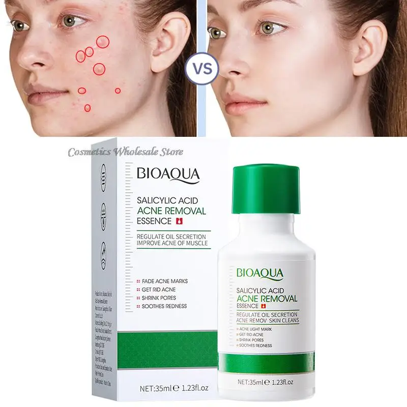 Picture of BIOAQUA Salicylic Acid Shrink Pores Face Serum Oil Control Remove Acne Blackheads Dark Spot Whitening Moisturizing Skin Care Essence -35ML