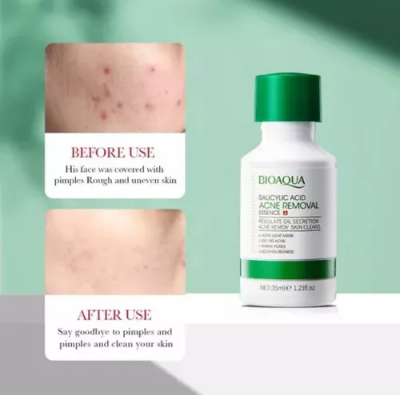 Picture of BIOAQUA Salicylic Acid Shrink Pores Face Serum Oil Control Remove Acne Blackheads Dark Spot Whitening Moisturizing Skin Care Essence -35ML