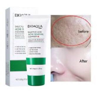 Picture of BIOAQUA SALICYLIC ACID ACNE REMOVAL CLEANSER MOISTURIZING OIL CONTROL PORE SHRINKING FACIAL CLEANSER 100G