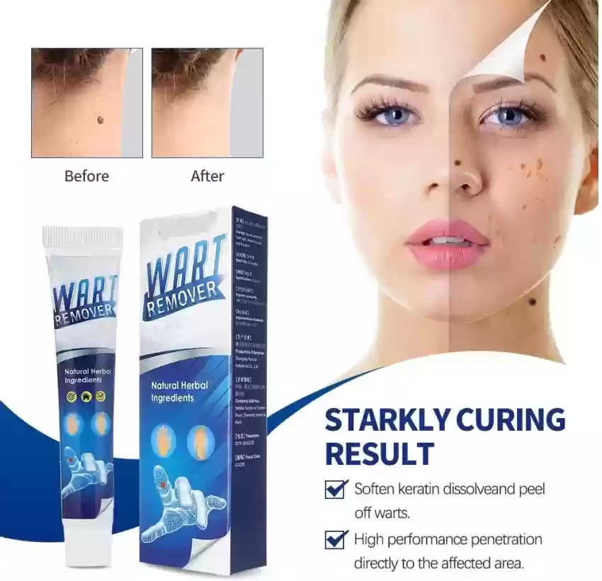 Picture of Warts Remover Ointment Wart Treatment Cream Skin Tag Remover Ointment-20gm