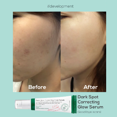 Picture of Axis-y Dark Spot Correcting Glow Serum 50ml
