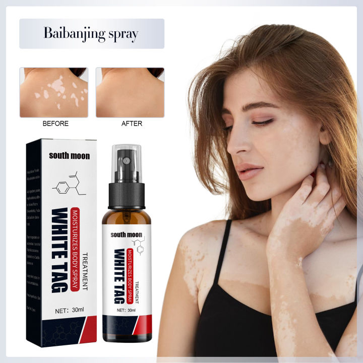Picture of South Moon Vitiligo Treatment Spray Moisturizing Reduces White Spots Leukoplakia Disease Pigment Melanin Repair White Tag Care-30ml