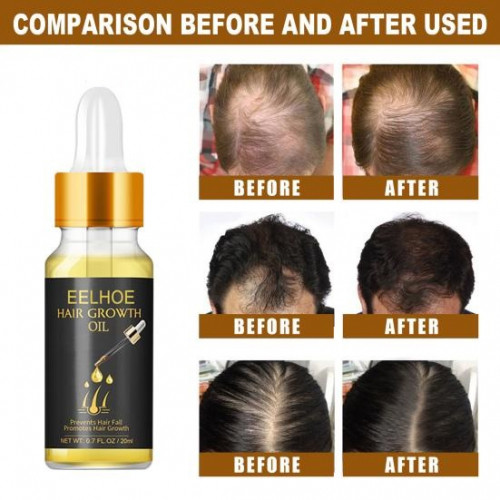 Picture of Eelhoe Hair Essential Oil for Scalp & Hair Care-20gm