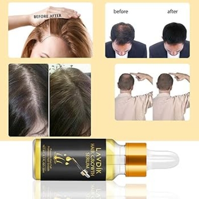 Picture of Eelhoe Hair Essential Oil for Scalp & Hair Care-20gm