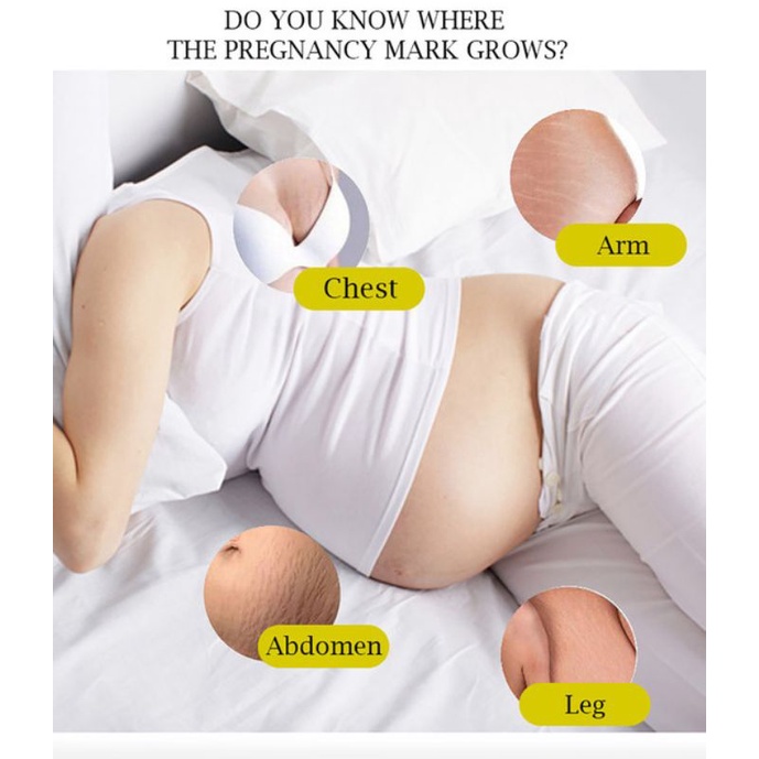 Picture of AICHUN BEAUTY Medical Formula Anti-Stretch Marks Cream -100ML