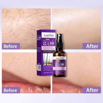 Picture of Sadoer Natural Inhibitor Hair Serum Remove Armpit Knee Leg Hair -30ml