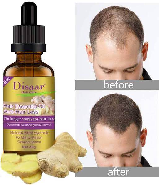 Picture of Disaar 30ml Fast Hair Growth Essential Oil Ginger Formula Anti-hair Loss Oil Head Scalp Treatment For Men And Women