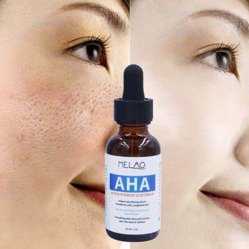 Picture of MELAO Natural Oil Control Pore Shrinking Serum Alpha Hydroxy Acid AHA Serum AHA Whitening Serum-30ml